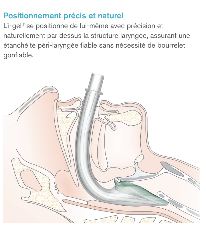 i-gel® - Dispositif supraglottiques i-gel®